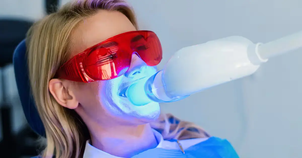 ZOOM whitening treatment result