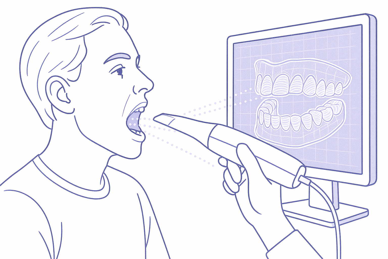 Invisalign treatment step 2: 3D Digital Scan